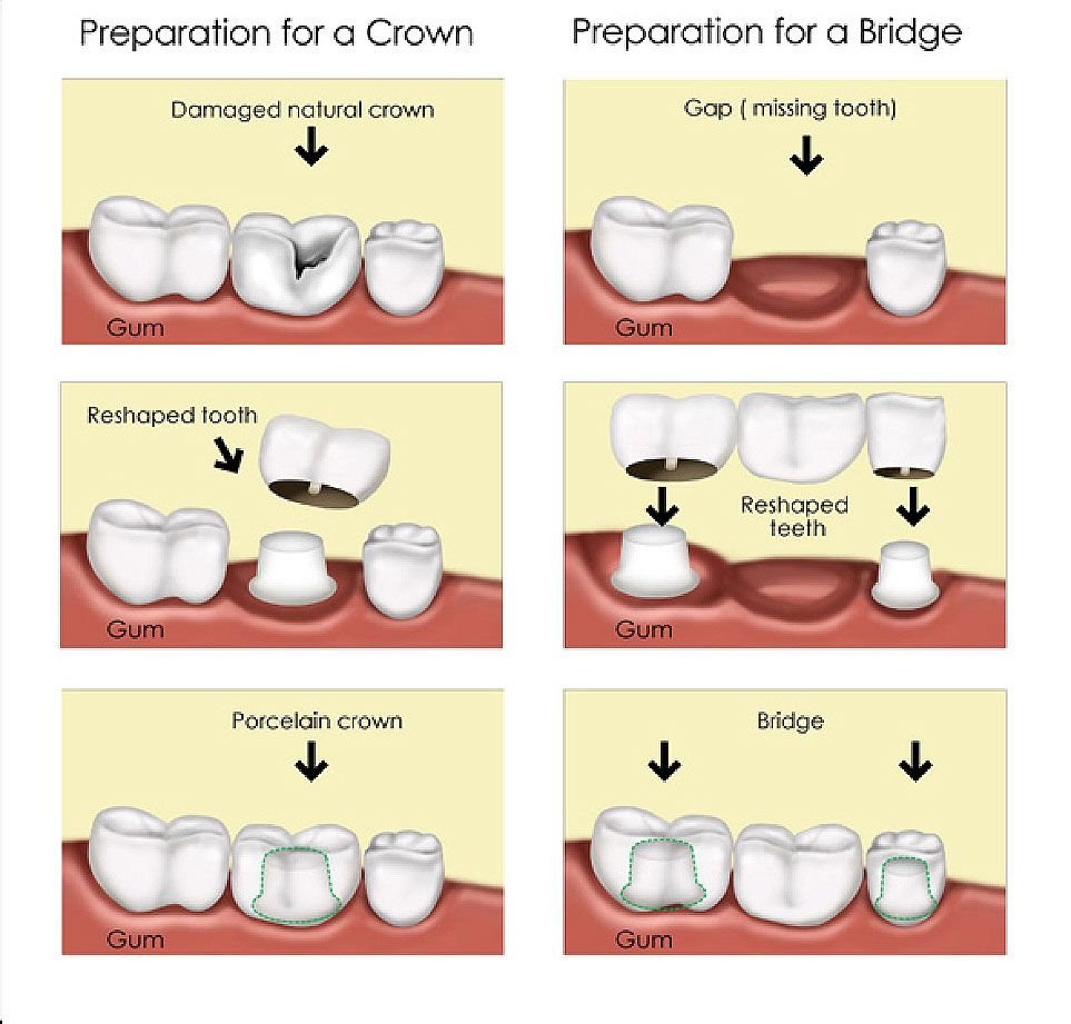 Happy Patient Smile at Miswak Dental Care