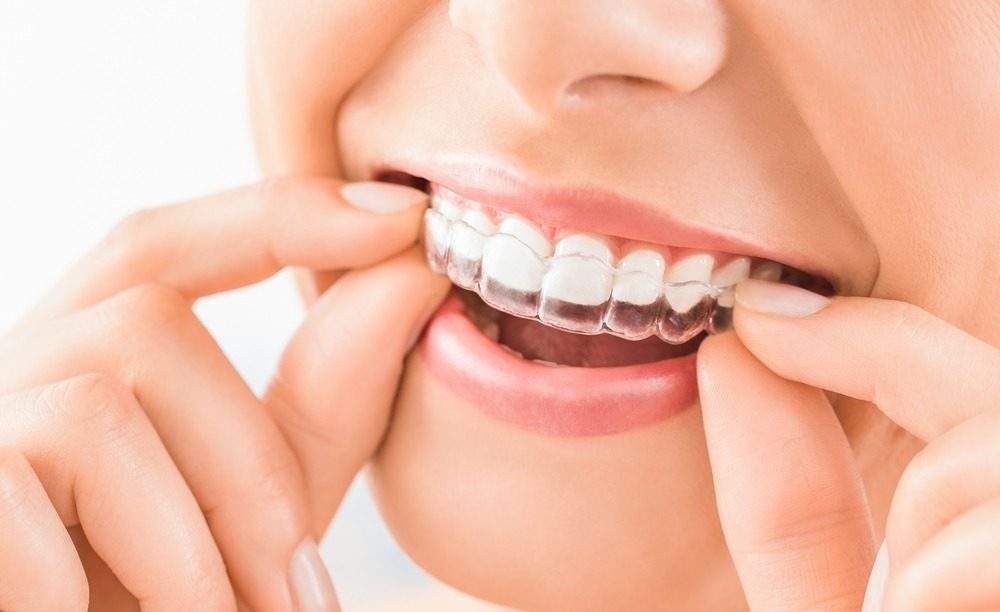 Happy Patient Smile at Miswak Dental Care