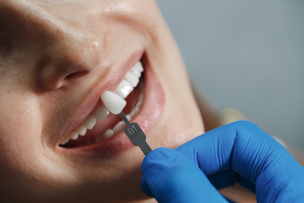 Happy Patient at Miswak Dental Care